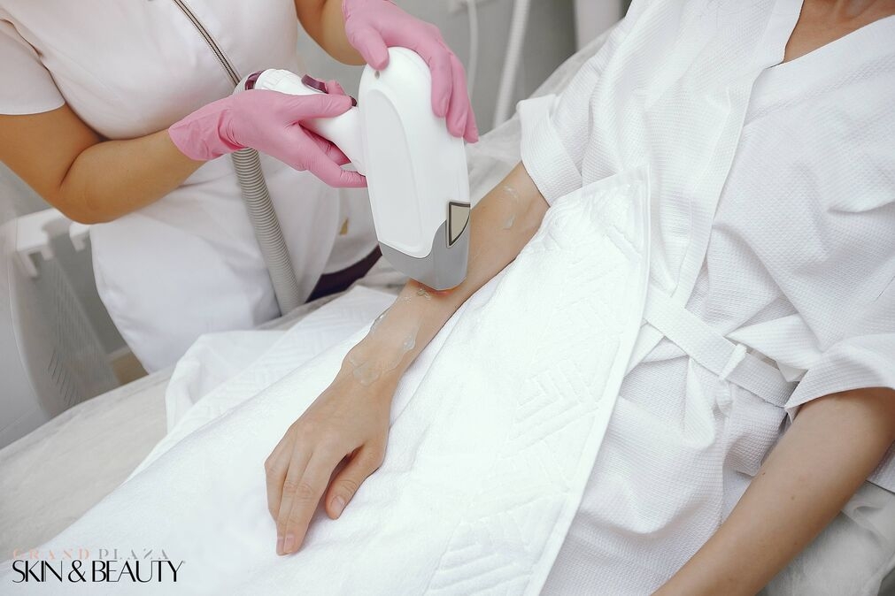 Is Full Body Permanent Hair Reduction in Browns Plains Right for You